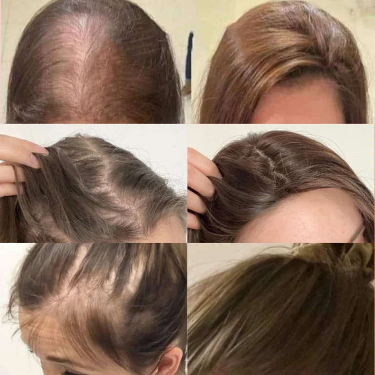 Bahan Alami Serum