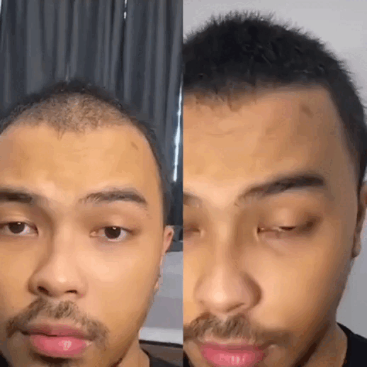 Before After Animation